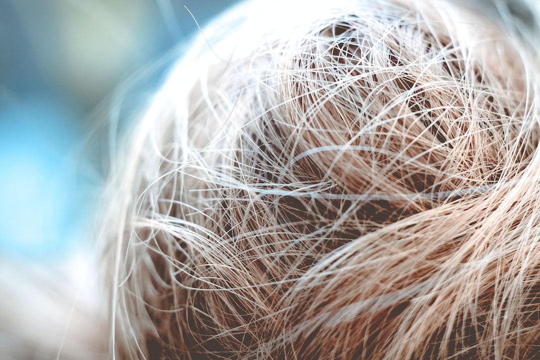 Przeszczep włosów: Odzyskaj pełną fryzurę i pewność siebie