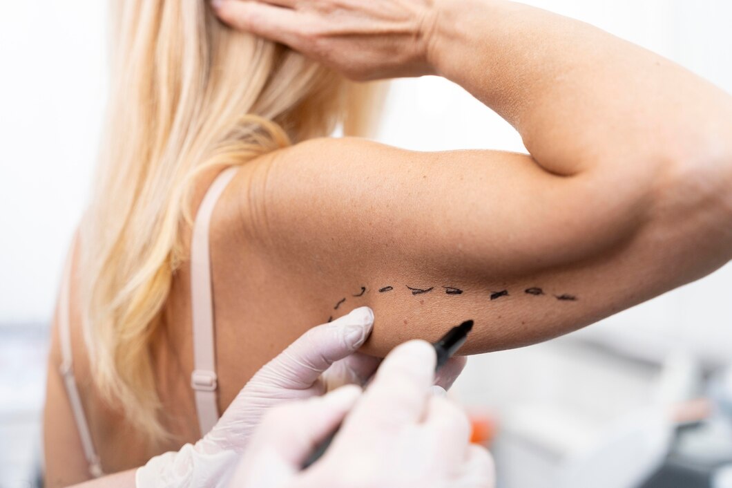 Czy laserowe usuwanie tatuażu jest bezpieczne? Mit czy prawda?